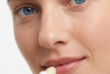 Lèvres sèches et gercées : 5 causes et solutions naturelles